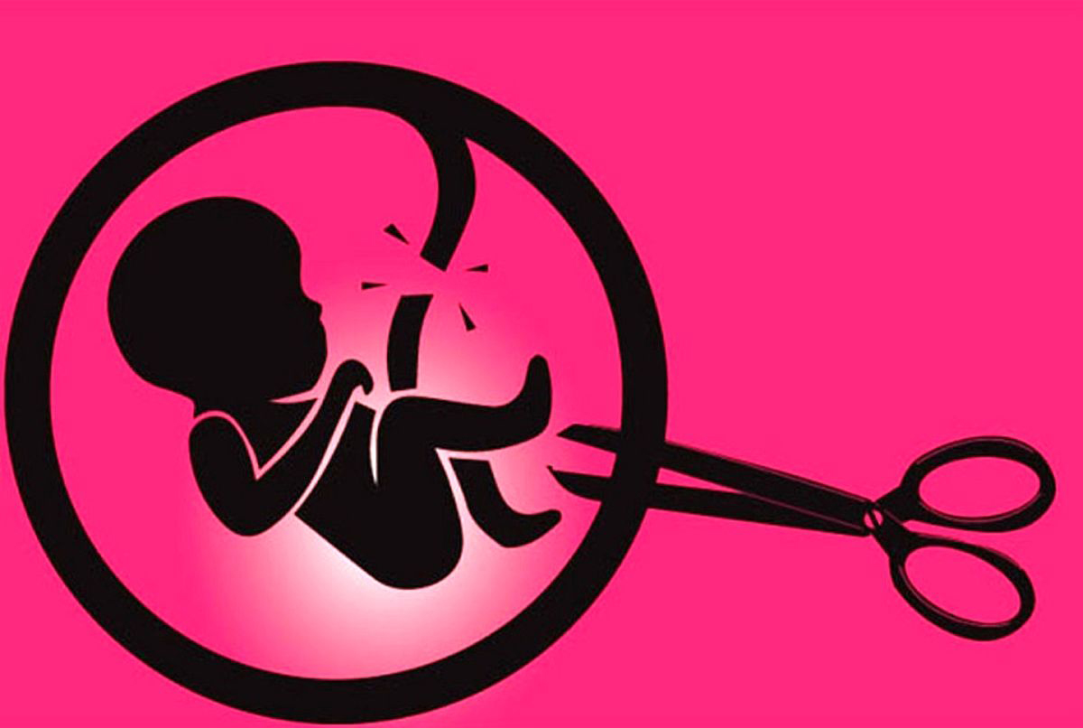 سقط خود به خودی جنین